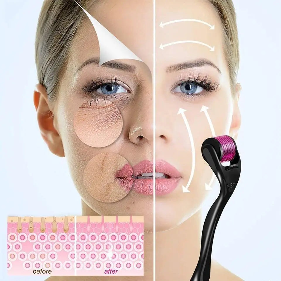 540 Derma Roller for Hair and Beard Growth 0.2/0.25/0.3mm Microneedle Anti Acne Face Skin Care Tool Dermaroller Face Roller